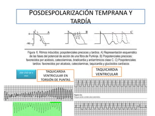 POSDESPOLARIZACIÓN TEMPRANA Y
TARDÍA
TAQUICARDIA
VENTRICULAR
TAQUICARDIA
VENTRICULAR EN
TORSIÓN DE PUNTAS
200-250 lat x
min
 