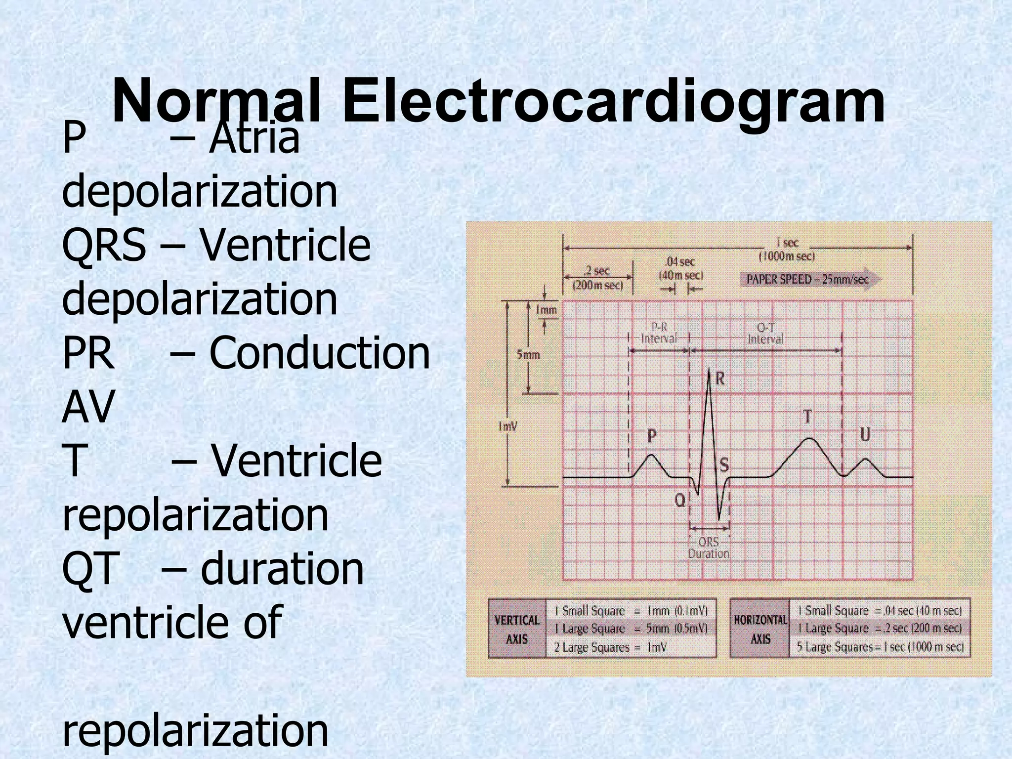 Normal Electrocardiogram   P  – Atria depolarization   QRS – Ventricle depolarization PR  – Conduction AV T  – Ventricle repolarization QT  – duration ventricle of    repolarization 