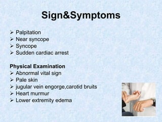 Sign&Symptoms Palpitation Near syncope Syncope Sudden cardiac arrest Physical Examination Abnormal vital sign  Pale skin jugular vein engorge,carotid bruits Heart murmur Lower extremity edema 