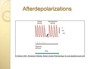 Afterdepolarizations
 