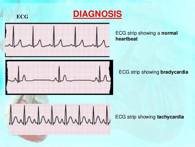cardiac output