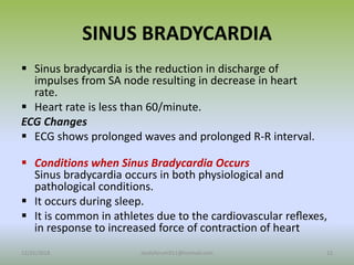 SINUS BRADYCARDIA
 Sinus bradycardia is the reduction in discharge of
impulses from SA node resulting in decrease in heart
rate.
 Heart rate is less than 60/minute.
ECG Changes
 ECG shows prolonged waves and prolonged R-R interval.
 Conditions when Sinus Bradycardia Occurs
Sinus bradycardia occurs in both physiological and
pathological conditions.
 It occurs during sleep.
 It is common in athletes due to the cardiovascular reﬂexes,
in response to increased force of contraction of heart
12/25/2018 12
studyforum911@hotmail.com
 