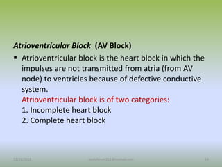 Atrioventricular Block (AV Block)
 Atrioventricular block is the heart block in which the
impulses are not transmitted from atria (from AV
node) to ventricles because of defective conductive
system.
Atrioventricular block is of two categories:
1. Incomplete heart block
2. Complete heart block
12/25/2018 19
studyforum911@hotmail.com
 