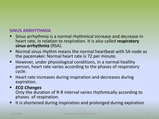 SINUS ARRHYTHMIA
 Sinus arrhythmia is a normal rhythmical increase and decrease in
heart rate, in relation to respiration. It is also called respiratory
sinus arrhythmia (RSA).
 Normal sinus rhythm means the normal heartbeat with SA node as
the pacemaker. Normal heart rate is 72 per minute.
 However, under physiological conditions, in a normal healthy
person, heart rate varies according to the phases of respiratory
cycle.
 Heart rate increases during inspiration and decreases during
expiration.
 ECG Changes
Only the duration of R-R interval varies rhythmically according to
phases of respiration.
 It is shortened during inspiration and prolonged during expiration
12/25/2018 5
studyforum911@hotmail.com
 