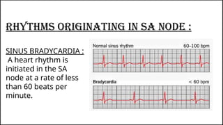 Sa Node Normal Rhythm Class presentation On Cardiovascular Disorder: Arrythmia..pptx