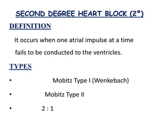SECOND DEGREE HEART BLOCK (2º)
DEFINITION
It occurs when one atrial impulse at a time
fails to be conducted to the ventricles.
TYPES
• Mobitz Type I (Wenkebach)
• Mobitz Type II
• 2 : 1
 
