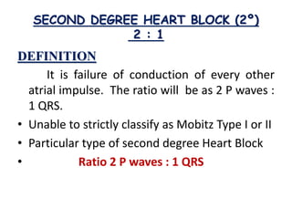 SECOND DEGREE HEART BLOCK (2º)
2 : 1
DEFINITION
It is failure of conduction of every other
atrial impulse. The ratio will be as 2 P waves :
1 QRS.
• Unable to strictly classify as Mobitz Type I or II
• Particular type of second degree Heart Block
• Ratio 2 P waves : 1 QRS
 