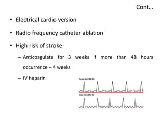 Cont…
• Electrical cardio version
• Radio frequency catheter ablation
• High risk of stroke-
– Anticoagulate for 3 weeks if more than 48 hours
occurrence – 4 weeks
– IV heparin
 