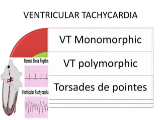 VENTRICULAR TACHYCARDIA
VT Monomorphic
VT polymorphic
Torsades de pointes
 