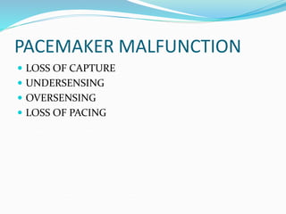 PACEMAKER MALFUNCTION
 LOSS OF CAPTURE
 UNDERSENSING
 OVERSENSING
 LOSS OF PACING
 