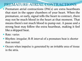 PREMATURE ATRIAL CONTRACTIONS
 Premature atrial contractions (PACs) are extra heartbeats
that start in the upper chambers of your heart. When the
premature, or early, signal tells the heart to contract, there
may not be much blood in the heart at that moment. That
means there’s not much blood to pump out. A pause and a
strong beat may follow the extra heartbeat, making it feel
like a skipped beat.
 Rate: varies
 Rhythm: irregular; R-R interval of a premature beat is shorter
than normal.
 Occurs when impulse is generated by an irritable area of tissue
in the atria.
 