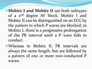  Mobitz I and Mobitz II are both subtypes
of a 2nd degree AV block. Mobitz I and
Mobitz II can be distinguished on an ECG by
the pattern in which P waves are blocked; in
Mobitz I, there is a progressive prolongation
of the PR interval until a P wave fails to
conduct.
 Whereas in Mobitz II, PR intervals are
always the same length, but are followed by
a pattern of one or more non-conducted P
waves.
 