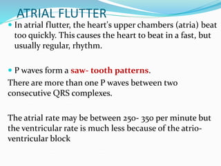 ATRIAL FLUTTER
 In atrial flutter, the heart's upper chambers (atria) beat
too quickly. This causes the heart to beat in a fast, but
usually regular, rhythm.
 P waves form a saw- tooth patterns.
There are more than one P waves between two
consecutive QRS complexes.
The atrial rate may be between 250- 350 per minute but
the ventricular rate is much less because of the atrio-
ventricular block
 