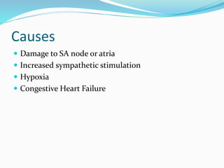 Causes
 Damage to SA node or atria
 Increased sympathetic stimulation
 Hypoxia
 Congestive Heart Failure
 