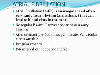 ATRIAL FIBRILLATION
 Atrial fibrillation (A-fib) is an irregular and often
very rapid heart rhythm (arrhythmia) that can
lead to blood clots in the heart.
 No regular P wave; P waves appearing as a wavy
baseline.
 Atria contract 350-600 times per minute. Ventricular
rate is variable
 Irregular rhythm
 P-R interval cannot be monitored
 