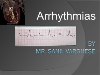 Arrhythmias

 