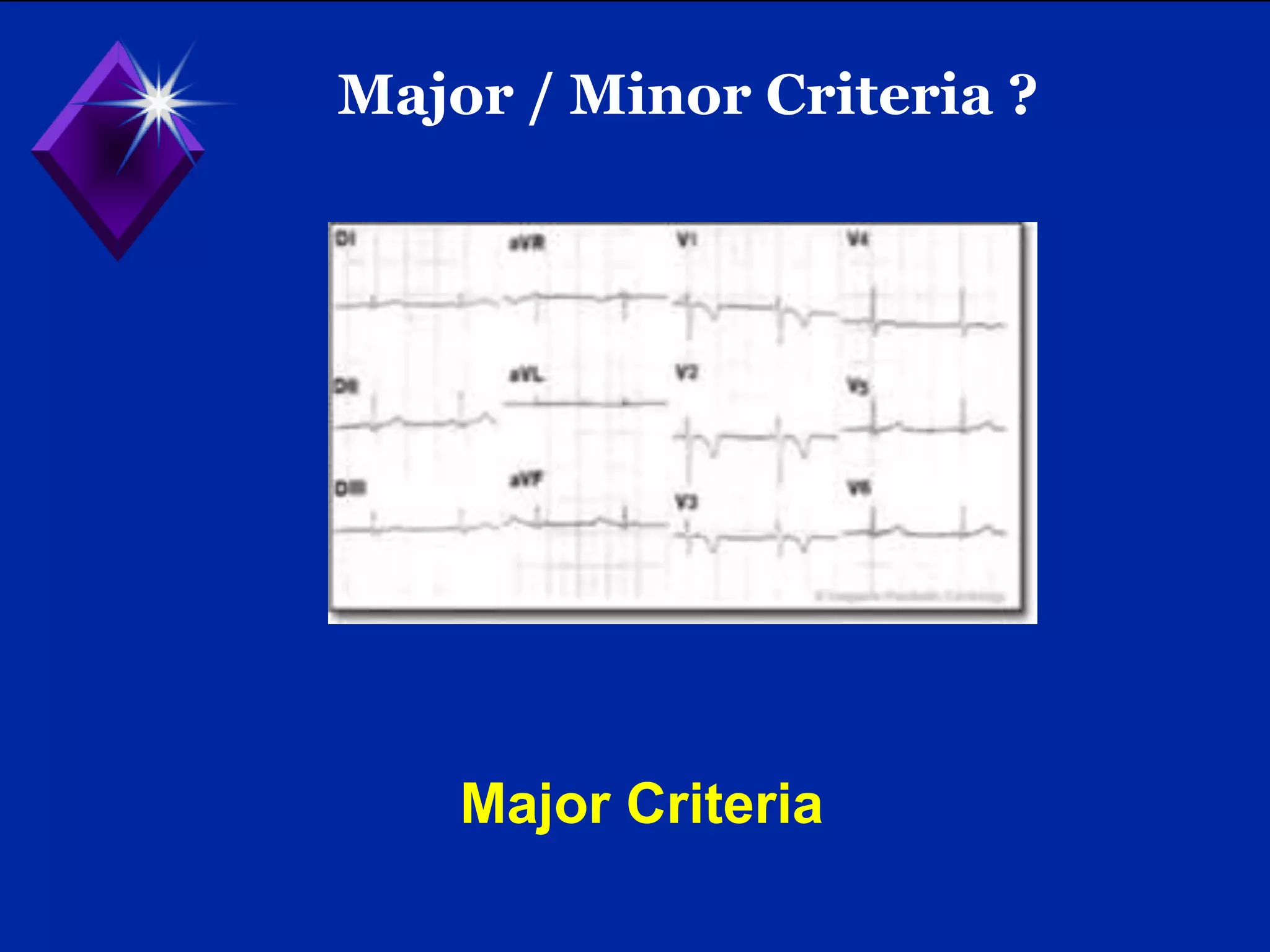 ARVD (Arrythmogenic right ventricular cardiomyopathy) - updated task ...