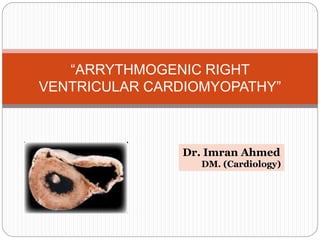 “ARRYTHMOGENIC RIGHT
VENTRICULAR CARDIOMYOPATHY”
Dr. Imran Ahmed
DM. (Cardiology)
 