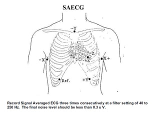 SAECG
 