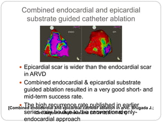 Combined endocardial and epicardial
substrate guided catheter ablation
 Epicardial scar is wider than the endocardial scar
in ARVD
 Combined endocardial & epicardial substrate
guided ablation resulted in a very good short- and
mid-term success rate.
 The high recurrence rate published in earlier
series may be due to the conventional only-
endocardial approach
[Combined endocardial and epicardial catheter ablation in arvc. Brugada J.;
Circulation: Arrhythmia and EP. 2012;5:111-121]
 