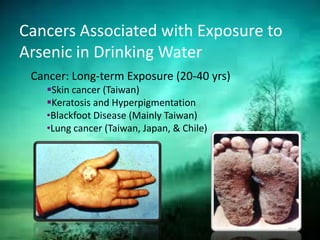 Cancers Associated with Exposure to
Arsenic in Drinking Water
Cancer: Long-term Exposure (20-40 yrs)
Skin cancer (Taiwan)
Keratosis and Hyperpigmentation
•Blackfoot Disease (Mainly Taiwan)
•Lung cancer (Taiwan, Japan, & Chile)
 