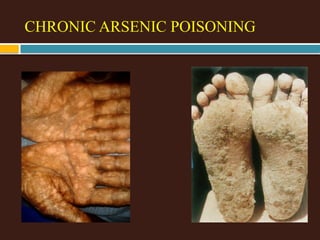 Comprehensive Overview of Arsenic Poisoning and Autopsy Procedures | PPTX