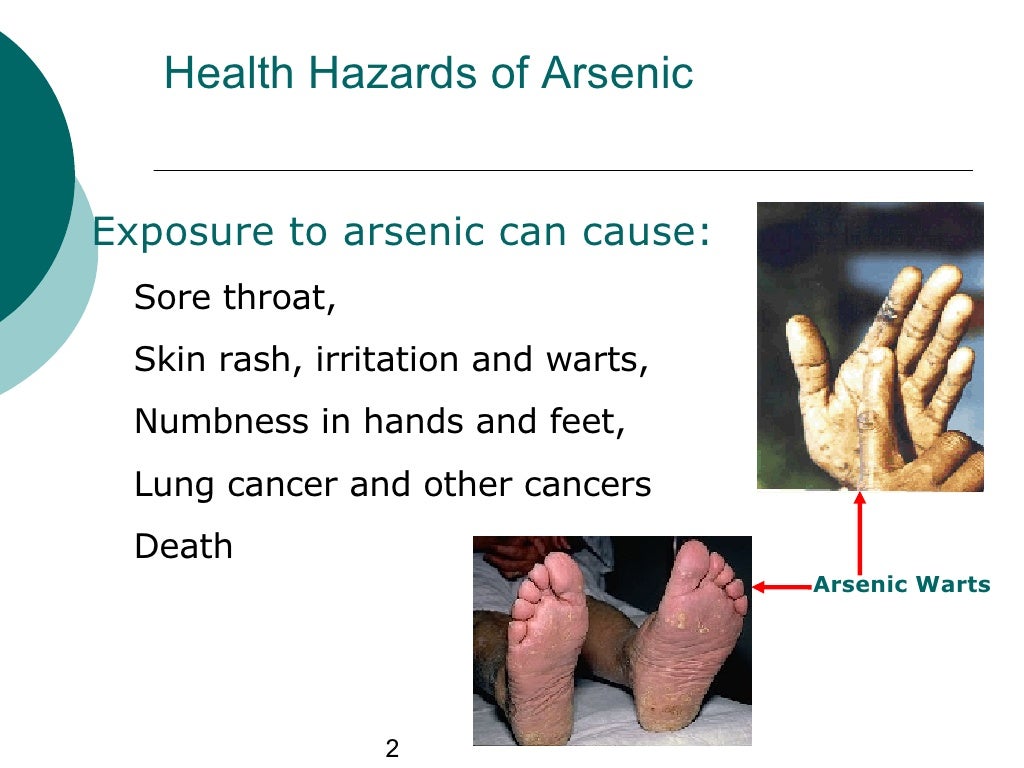 Arsenic Health Hazards