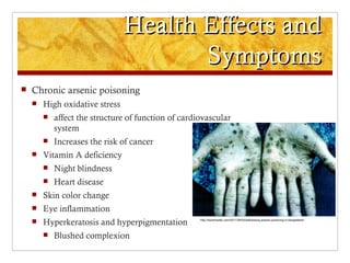 Health Effects and
                                       Symptoms
   Chronic arsenic poisoning
       High oxidative stress
           affect the structure of function of cardiovascular
            system
           Increases the risk of cancer
       Vitamin A deficiency
           Night blindness
           Heart disease
       Skin color change
       Eye inflammation
       Hyperkeratosis and hyperpigmentation         http://wewinwater.com/2011/09/03/addressing-arsenic-poisoning-in-bangladesh/




           Blushed complexion
 