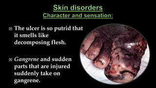  The ulcer is so putrid that
it smells like
decomposing flesh.
 Gangrene and sudden
parts that are injured
suddenly take on
gangrene.
 