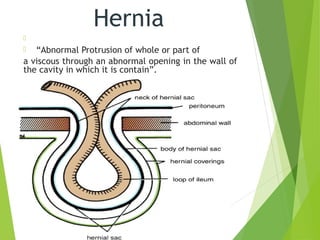Hernia

 “Abnormal Protrusion of whole or part of
a viscous through an abnormal opening in the wall of
the cavity in which it is contain”.
 