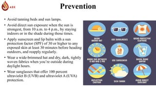 Skin Cancer | PPTX