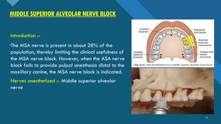 LOCAL ANESTHESIA IN ORAL AND MAXILLOFACIAL SURGERY | PDF