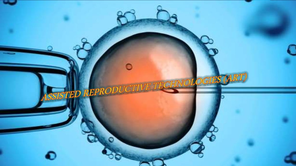 ART ( ASSISTED REPRODUCTIVE TECHNOLOGIES).THIS THE ARTIFICIAL REPRODU…