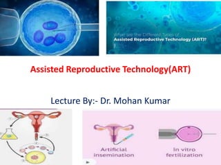 Assisted Reproductive Technology(ART)
Lecture By:- Dr. Mohan Kumar
 