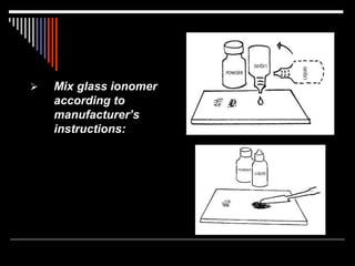  Mix glass ionomer
according to
manufacturer’s
instructions:
 