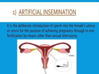 Assisted Reproductive Technology (ART): Advances in Infertility ...
