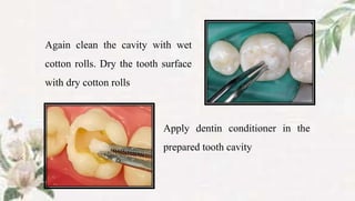 Again clean the cavity with wet
cotton rolls. Dry the tooth surface
with dry cotton rolls
Apply dentin conditioner in the
prepared tooth cavity
 