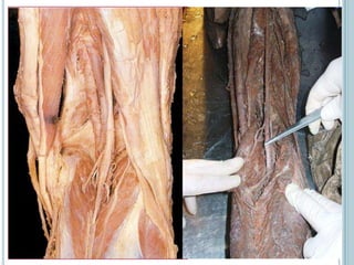 Profunda y muscular.ArteriaPopliteaOrigenDistal al hiato del aductor Continúa a la arteria femoralTrayecto y relacionesFosa poplíteaRamas colaterales-Arterias superiores de la rodilla (2)-Arterias media -Arteria inferiores de la rodilla (2) --» RED ROTULIANA-Arterias surales. (2)