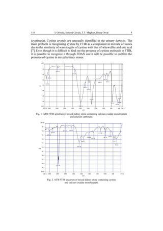 I. Oswald, Simona Cavalu, T.T. Maghiar, Diana Osvat 4110
(cystinuria). Cystine crystals are unusually identified in the urinary deposits. The
main problem is recognizing cystine by FTIR as a component in mixture of stones
due to the similarity of wavelengths of cystine with that of whewellite and uric acid
[7]. Even though it is difficult to find out the presence of cystine molecule in FTIR,
it is possible to recognize it through EDAX and it will be possible to confirm the
presence of cystine in mixed urinary stones.
3022.6 2800 2400 2000 1800 1600 1400 1200 1000 800 600 504.8
84.2
86
88
90
92
94
96
98
100.2
cm-1
%R
1307.03
774.54
1582.14
2354.19
1738.48
2851.21
2925.47
1462.75
1374.63
1090.37
948.25
888.55
644.09
584.40
Fig. 1. ATR FTIR spectrum of mixed kidney stone containing calcium oxalate monohydrate
and calcium carbonate.
3011.2 2800 2400 2000 1800 1600 1400 1200 1000 800 570.6
94.02
94.5
95.0
95.5
96.0
96.5
97.0
97.5
98.0
98.5
99.0
99.5
100.03
cm-1
%R
2821.22
2625.69
2357.54
2016.75 1849.83
1652.38
1546.71
1404.88 987.75
870.95
779.18
701.32
1297.65
1111.09
Fig. 2. ATR FTIR spectrum of mixed kidney stone containing cystine
and calcium oxalate monohydrate.
 