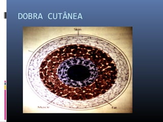 DOBRA CUTÂNEA 
 