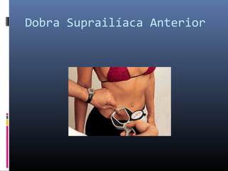 Dobra Suprailíaca Anterior 
 