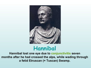 Hannibal
Hannibal lost one eye due to conjunctivitis seven
months after he had crossed the alps, while wading through
a fetid Etruscan (= Tuscan) Swamp.
 