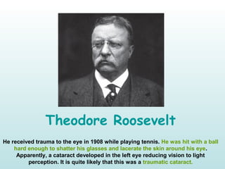 Theodore Roosevelt
He received trauma to the eye in 1908 while playing tennis. He was hit with a ball
hard enough to shatter his glasses and lacerate the skin around his eye.
Apparently, a cataract developed in the left eye reducing vision to light
perception. It is quite likely that this was a traumatic cataract.
 