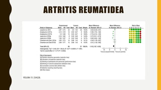 ARTRITIS REUMATIDEA
 