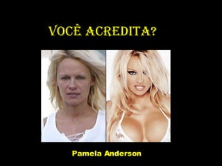 Você acredita? Pamela Anderson  