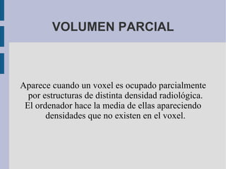 VOLUMEN PARCIAL Aparece cuando un voxel es ocupado parcialmente por estructuras de distinta densidad radiológica. El ordenador hace la media de ellas apareciendo densidades que no existen en el voxel. 
