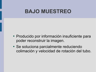 BAJO MUESTREO Producido por información insuficiente para poder reconstruir la imagen. Se soluciona parcialmente reduciendo colimación y velocidad de rotación del tubo. 