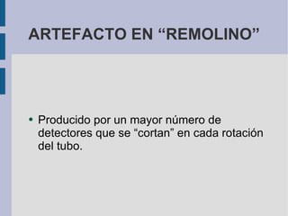 ARTEFACTO EN “REMOLINO” Producido por un mayor número de detectores que se “cortan” en cada rotación del tubo. 
