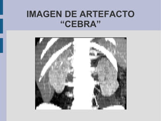 IMAGEN DE ARTEFACTO “CEBRA” 