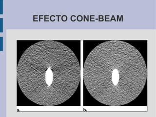 EFECTO CONE-BEAM 